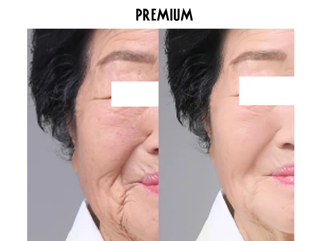 상세이미지-4