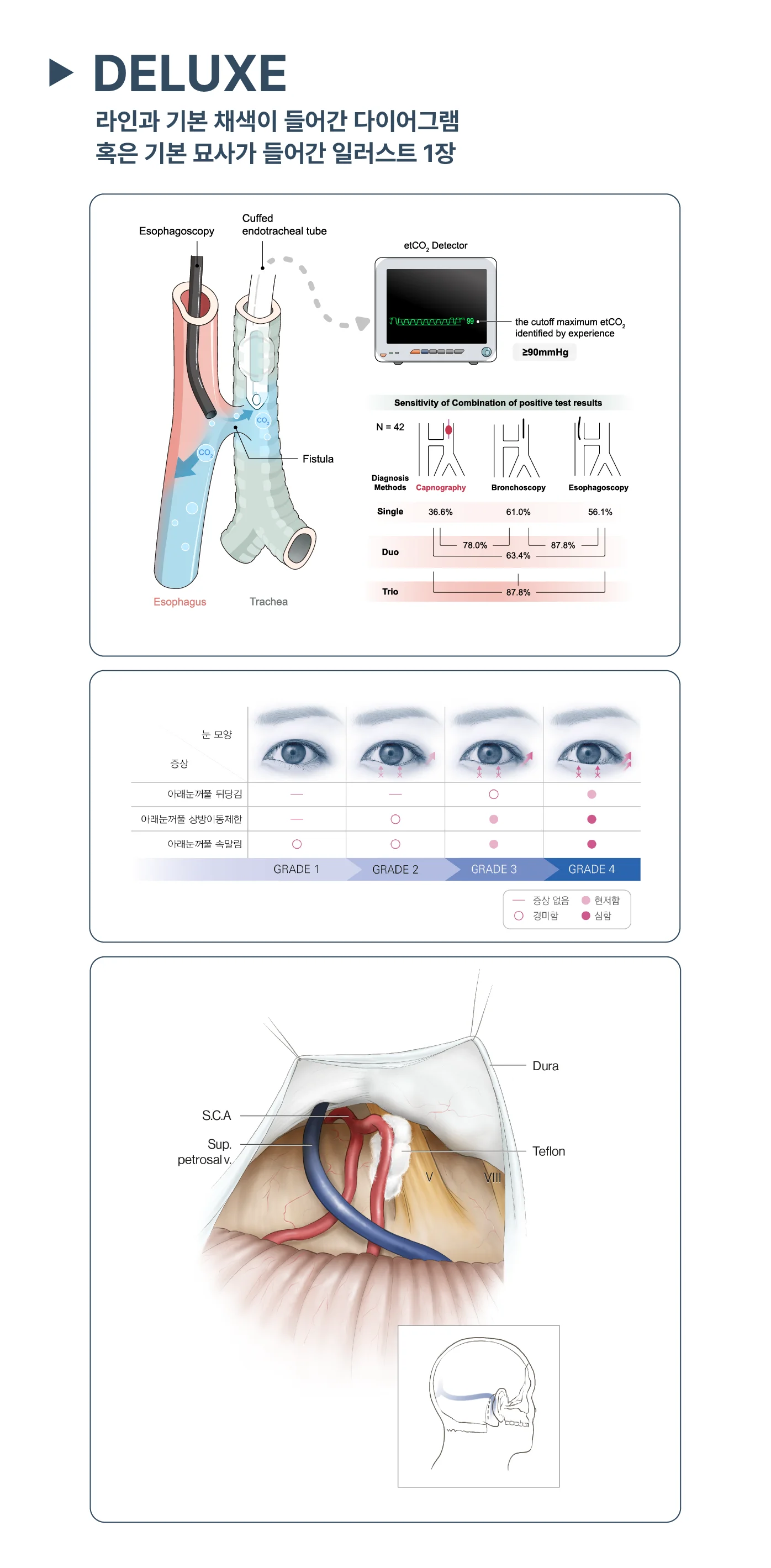 상세이미지-1