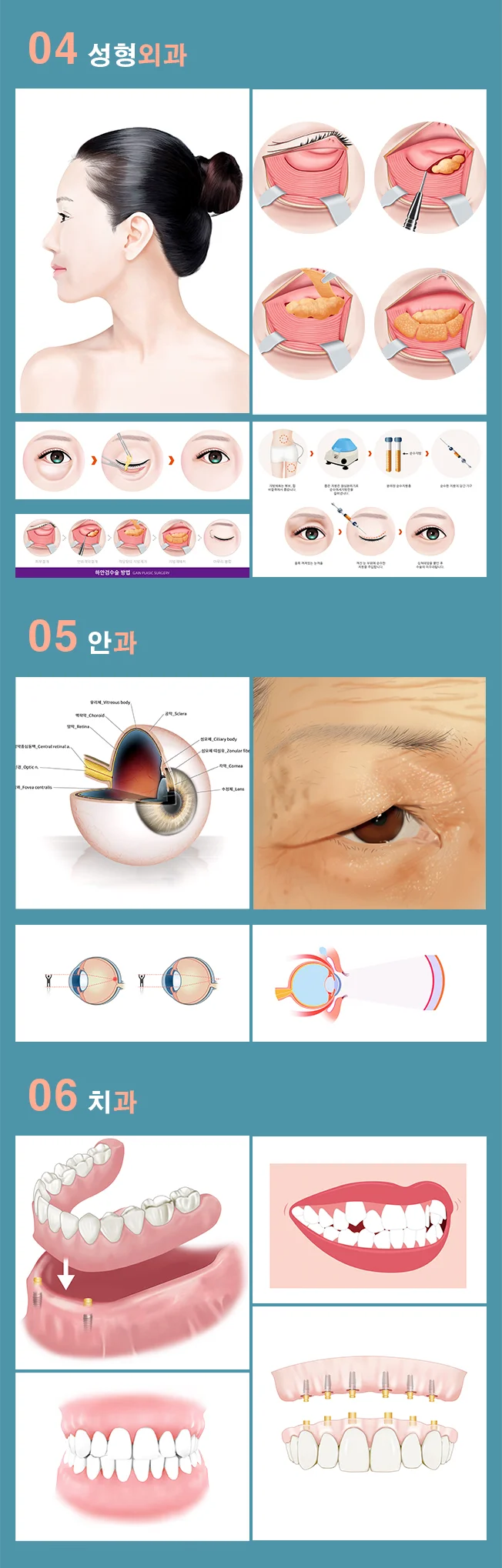 상세이미지-1