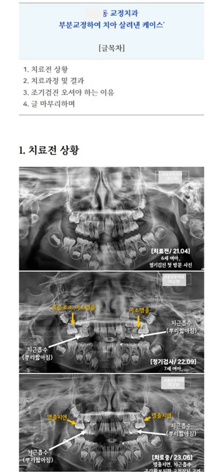 상세이미지-2