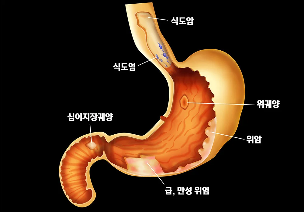 상세이미지-2