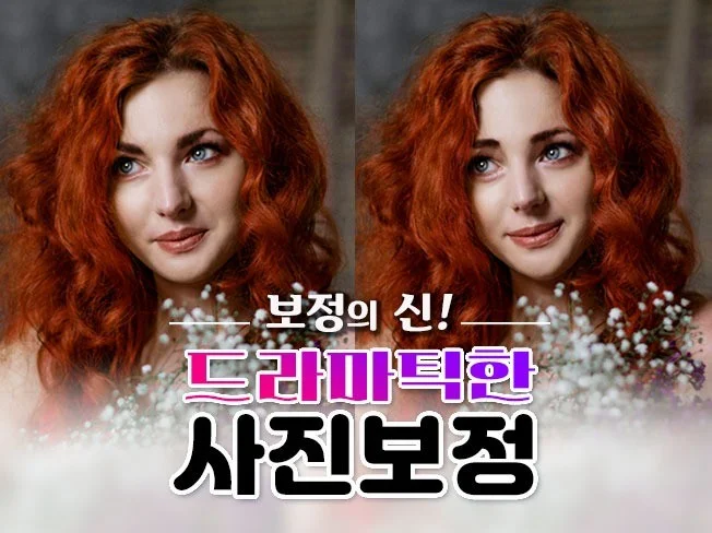 관상 성형 썸네일