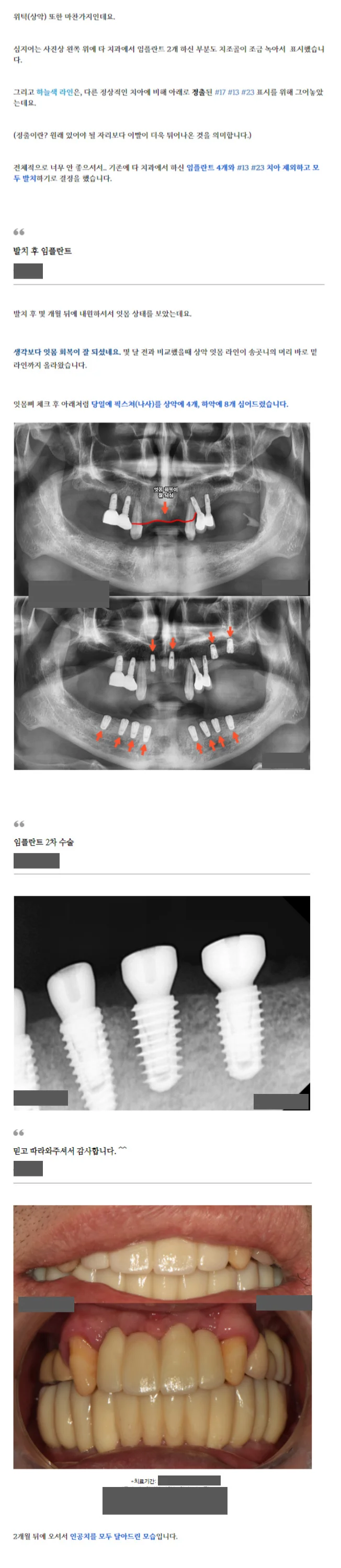 상세이미지-1