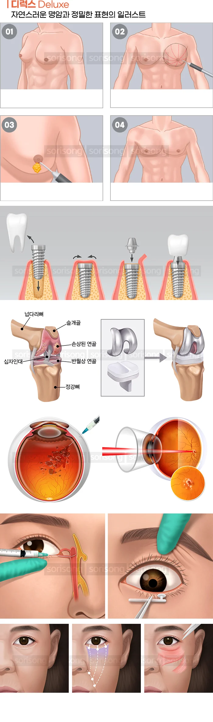 상세이미지-1