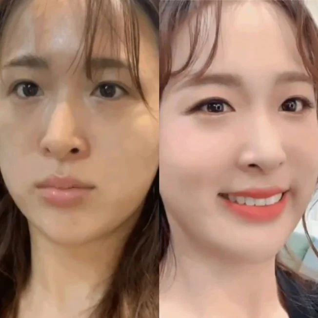 타임라인_1번째