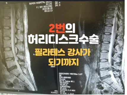 허리디스크 2번 수술후 필라테스 강사가 되기까지