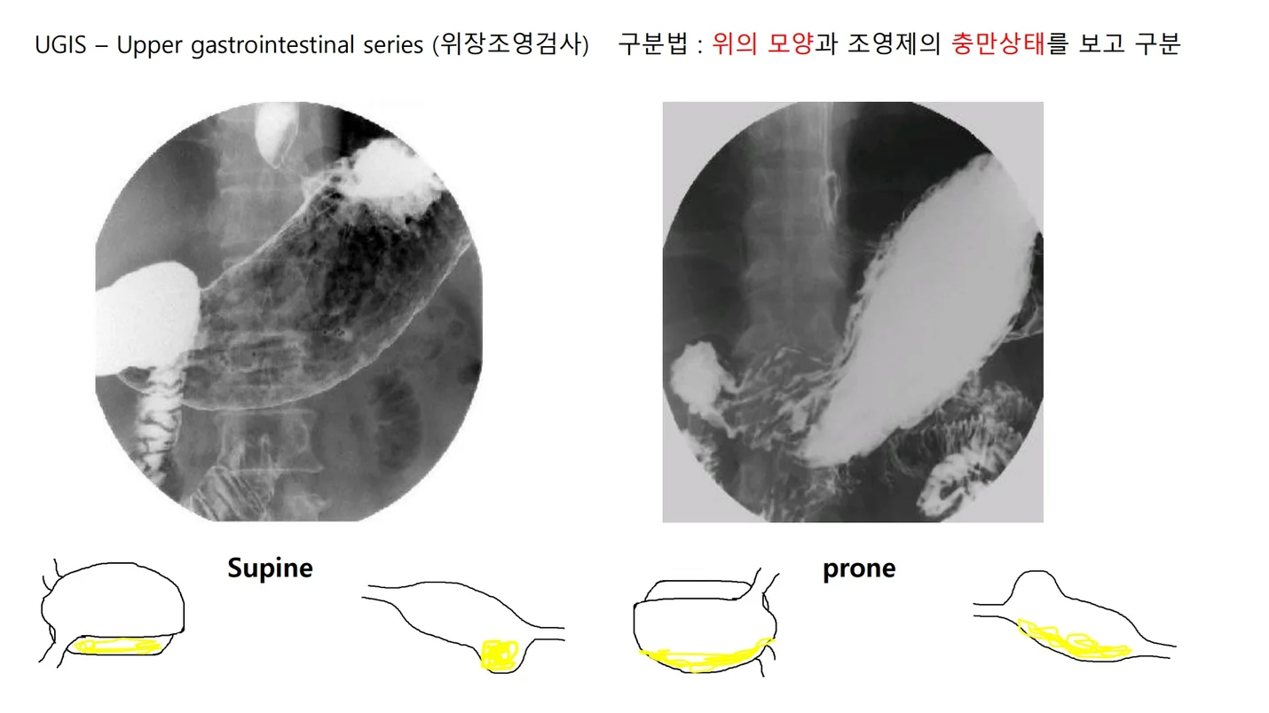 상세이미지-1