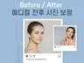 자연스러운 고퀄리티 인물보정, 병원 메디컬 전후사진
