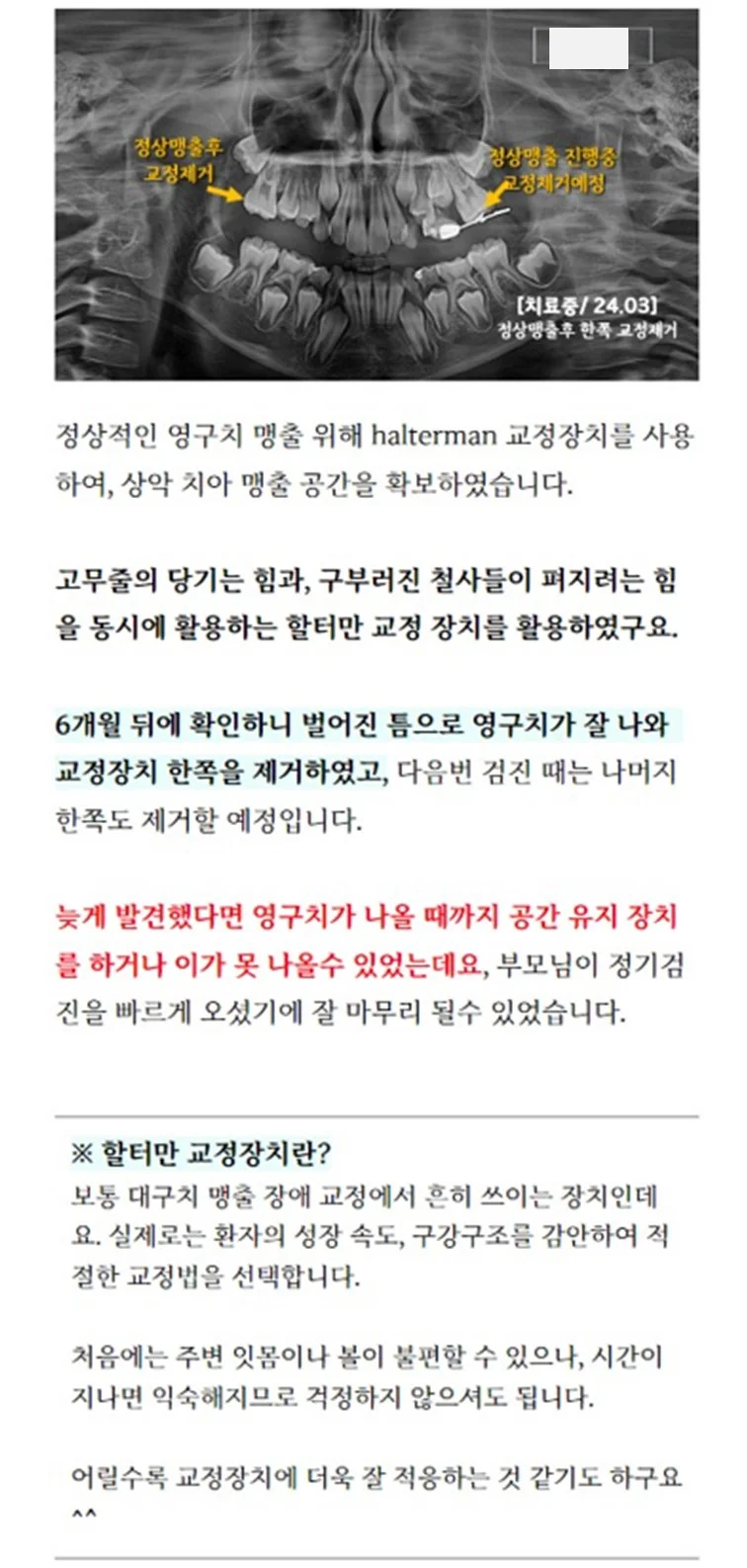 상세이미지-4