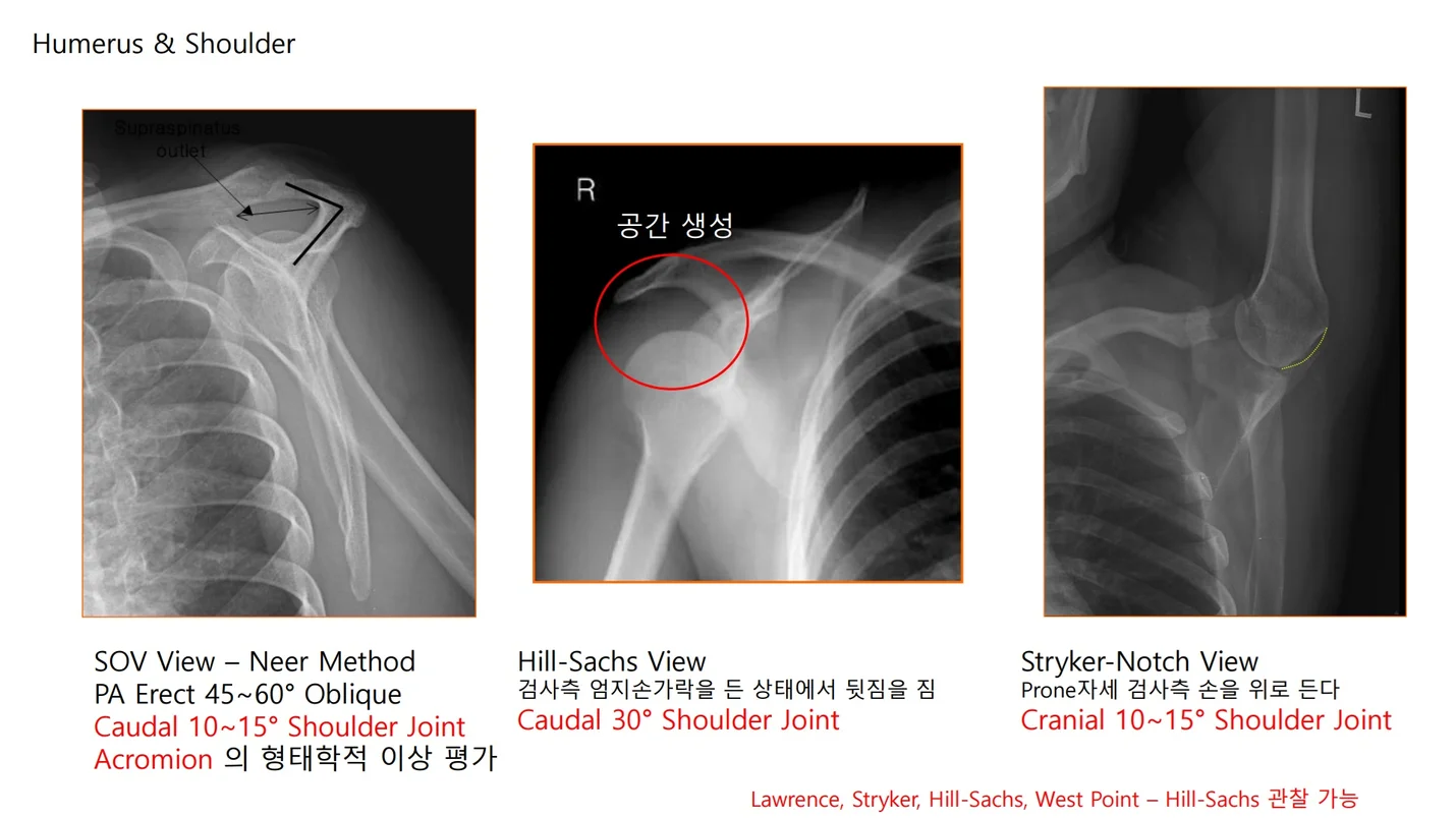 상세이미지-1