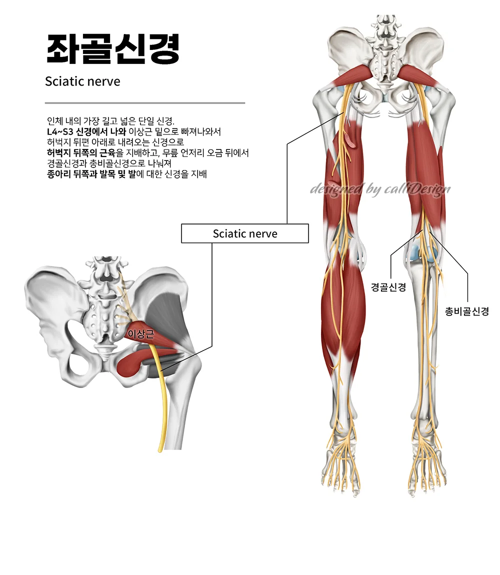 상세이미지-1