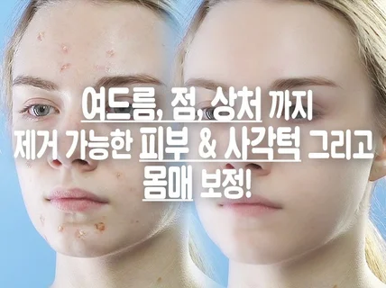 여드름, 점 제거, 피부, 사각턱, 몸매 보정 해드려요