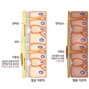 포트폴리오