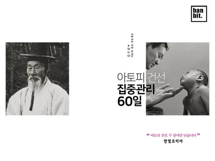 아토피 건선, 2달이면 낫게 하는 비법서 드립니다.