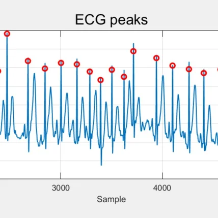 포트폴리오-ECG feature extraction and event detection