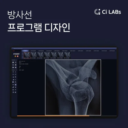 포트폴리오-방사선 프로그램 디자인