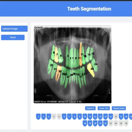 포트폴리오-치과 구강 X-ray 이미지를 통한 치아 번호 분할/식별 모델 및 웹 어플리케이션 개발