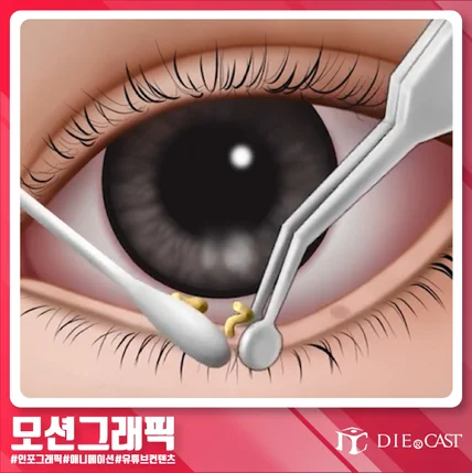 포트폴리오-[디자인/모션그래픽] 천안나안과 피부관리 애니메이션 홍보영상